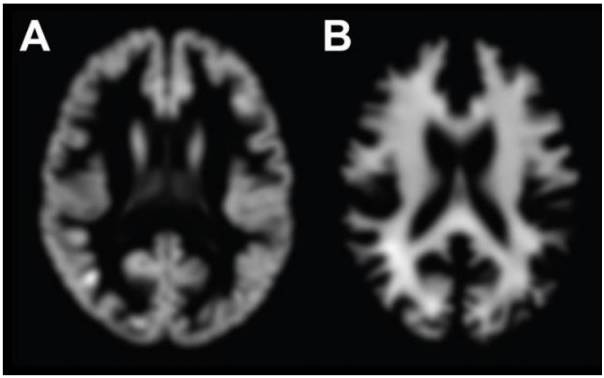 几秒钟就能测出你的“脑龄”，深度学习再晋级